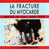 Fracture De Myocarde, La (1991)
